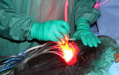Photodynamic Therapy